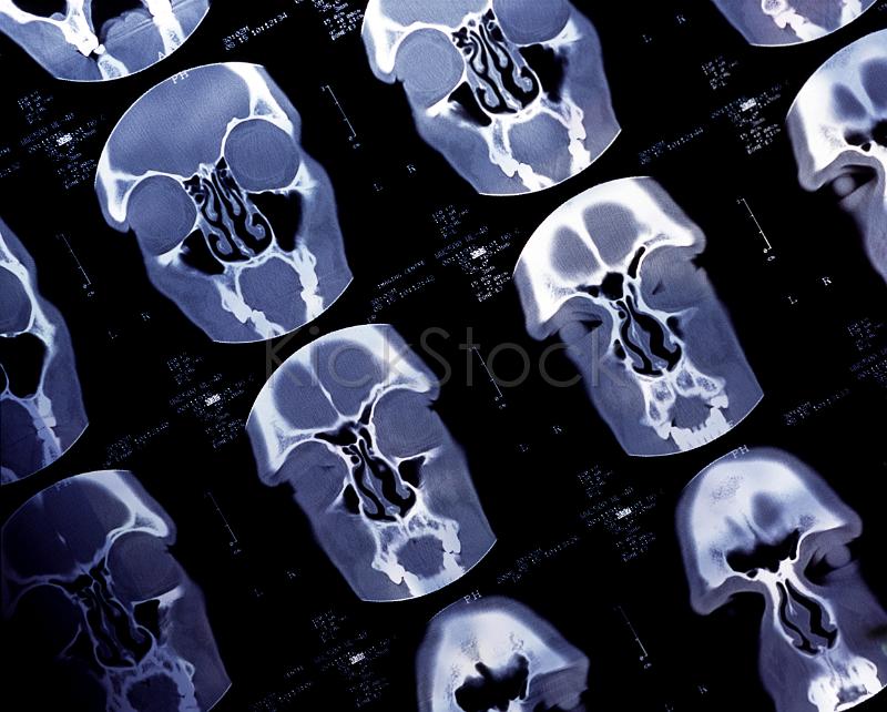 ct scan of a human head