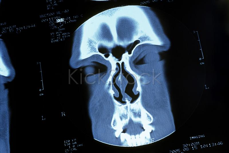 ct scan of a human head